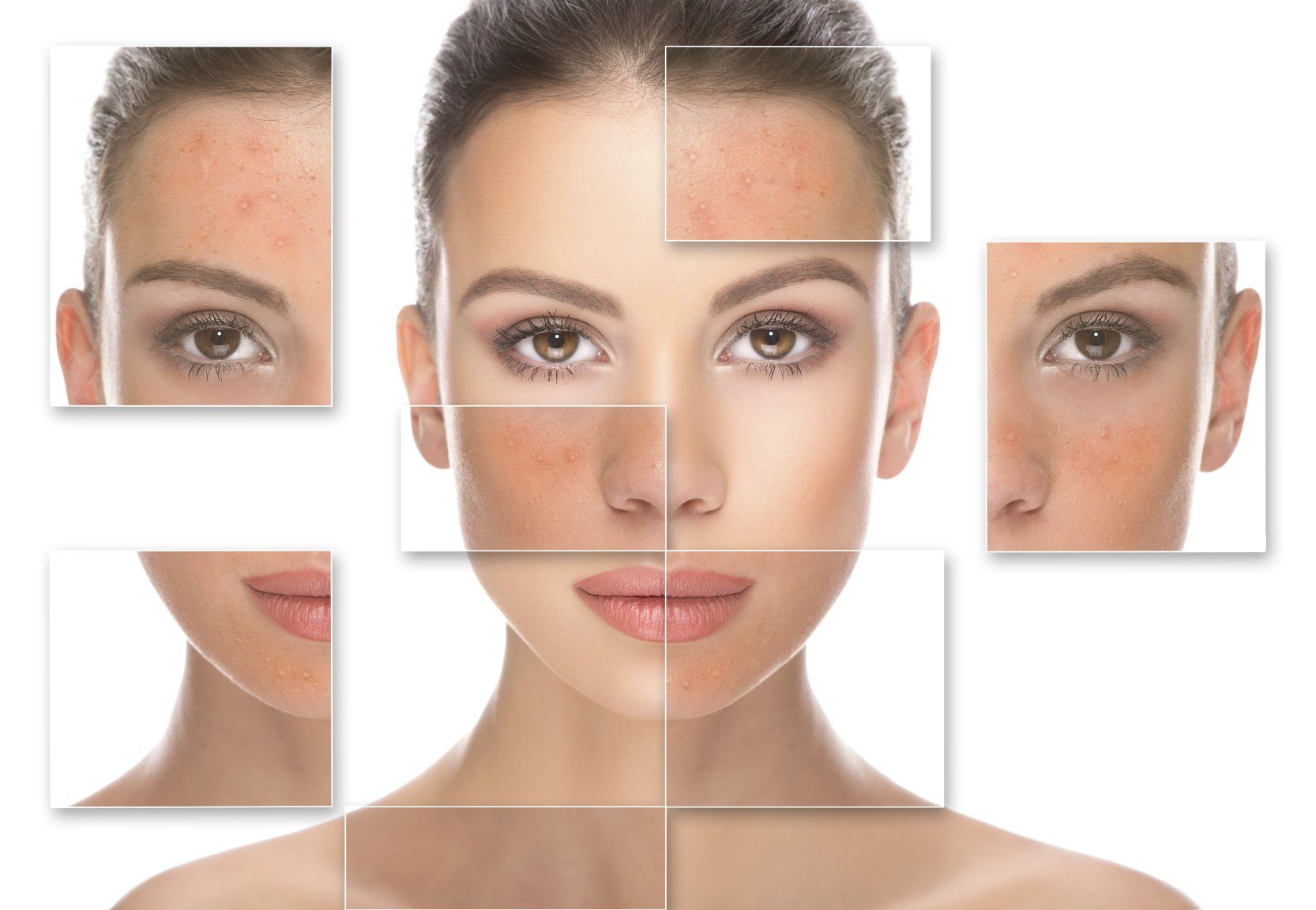 Blemish & Oily Problematic Skin Treatments
